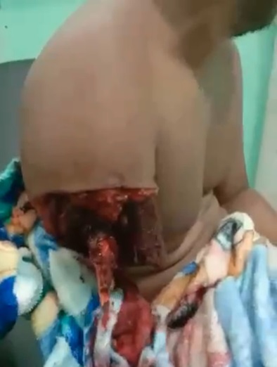 Crocodile Let Him Live, But Took A Part Of Him