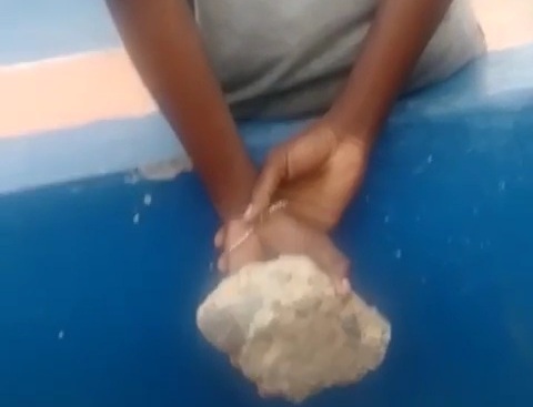 Massive Stone to the HEAD During Basketball Game.