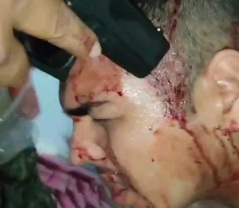 Two Ecuadorian army soldiers captured tied up and filled with dynamit