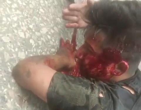 Motorcyclist crashed by out of control truck 