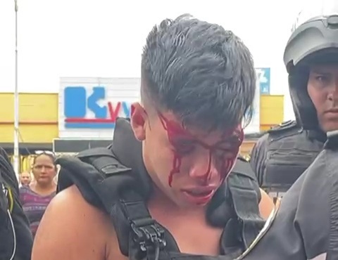 TRAFFIC OFFICER BROKE the head and LEADED the EYE of a CIVIL POLICEMAN