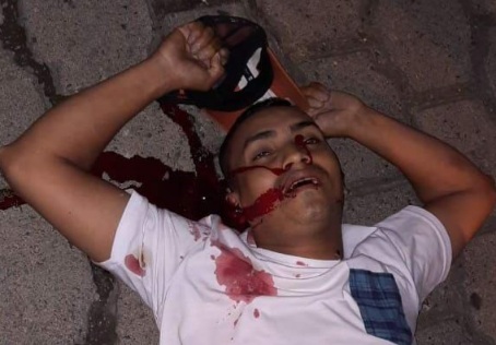 Taxi driver and motorcyclist are the victims of sicario attack 