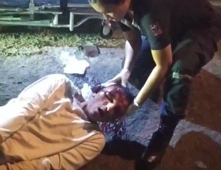 Motorcyclist skull cracked after getting crashed by truck 