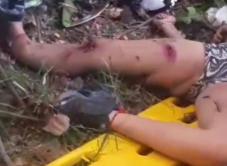 Couple on motorcycle crashed on tree 