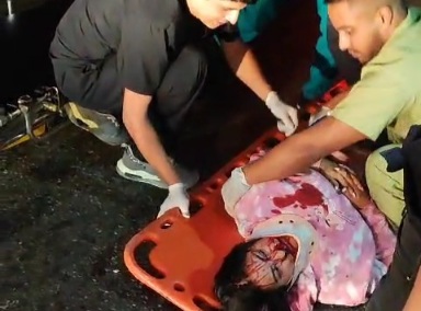 Woman crashed by speeding car transported to hospital 