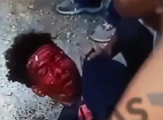 Sicario Misses his Shot and his Target Still Alive 