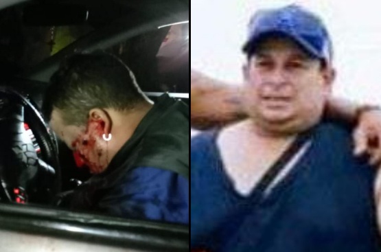 Fat man driving his car executed by sicario 