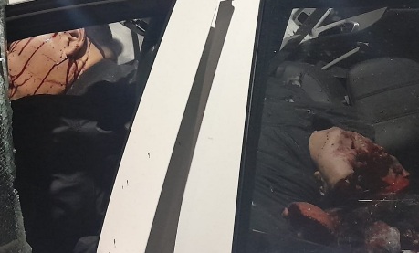 Horrible car crash leave passenger with crashed skull 