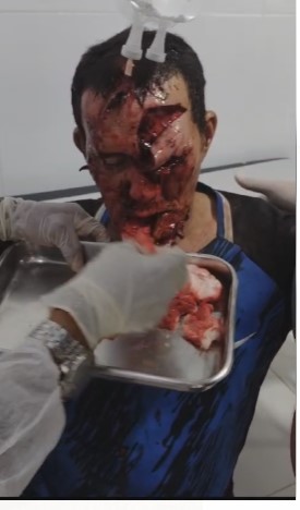 Dude BRUALLY Beaten with a Machete