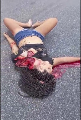 Woman is the Victim of a Terrible Accident