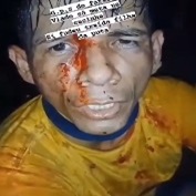 Beheaded by Rival Gang for Talking Crap.