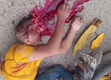 [BRAIN ON THE ASPHALT] MOTORCYCLIST HEAD CRASHED BY TAXI DRIVER 