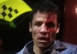 Thief captured and punished hard by angry crowds, saved by police 