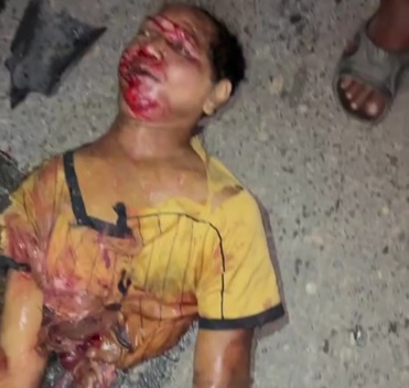 A half body all is left from pedestrian crashed by truck 