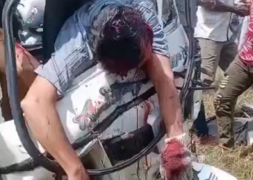 Horrific deadly accident happened in cartagena road 