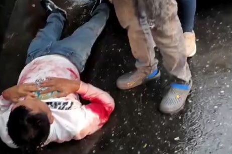 Young man shoot by sicario 