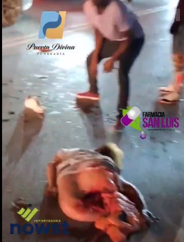 DAMNL Chicks Body Dismembered in an Accident