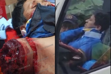 DRIVER LOST HIS ARM IN A HORRIFIC CRASH.
