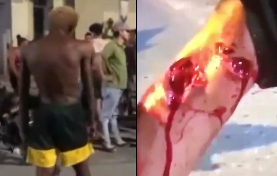 people WERE INJURED due to GLASS BOTTLES THROWING