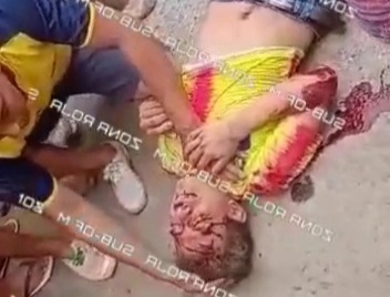 [ACCIDENT AND AFTERMATH]Horrific motorcycle accident 