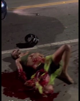 (FULL) Very Serious Accident in Búzios Brazil