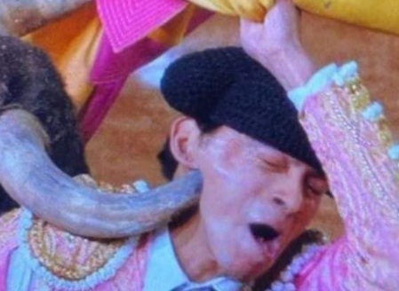 ALBERTO ORTEGA, Receives SEVERE GORING in the NECK 