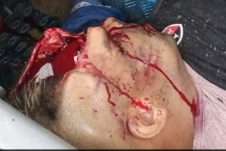 [BRAIN ON THE ASPHALT]MAN GETS SHOOT BY SICARIO 