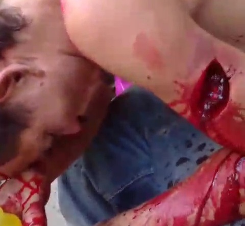 Drunk man attacked by machete after argument with his neighbor 