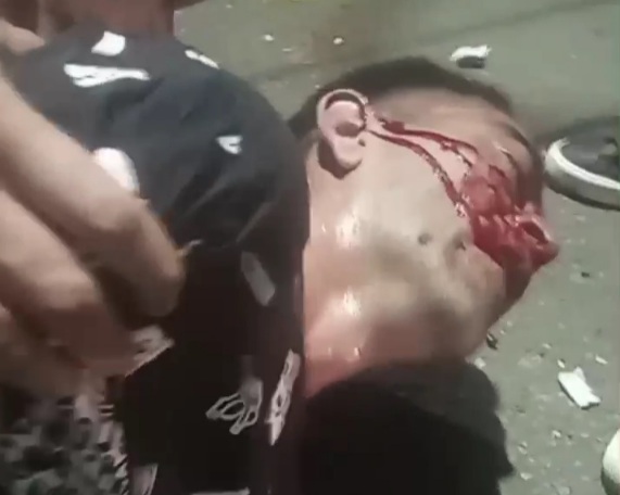 Two motorcyclists seriously injured after brutal collision 