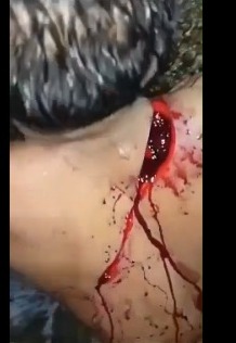 man cut with machete