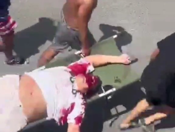 Fat man victime of armed robbery transport to hospital 