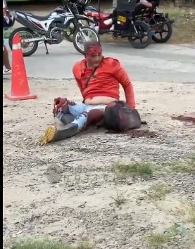 victims seriously injured in the leg and head