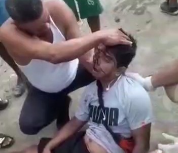 CRASH BETWEEN A MOTORCYCLE AND A CAR LEAVES ONE PERSON DEAD