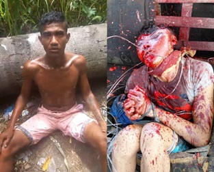 Drug Addict Loses His Mind and Mangles and Tortures His Best Friend 