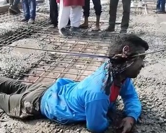 man has face cut with electric shock energy