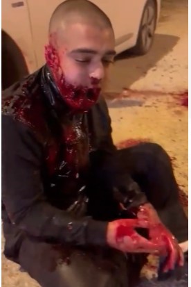 Russian man shot in the mouth