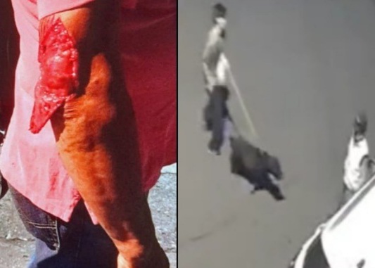 Rottweiler attacked old man 