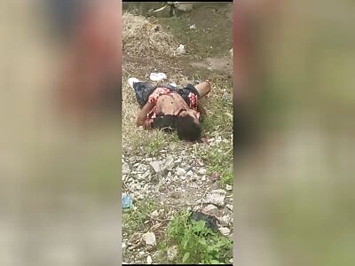 Subject had an explosive device explode 