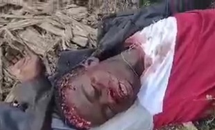 Young man butchered by gang members in Haiti 