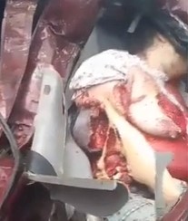 Lady Dead with Boob out in Accident.