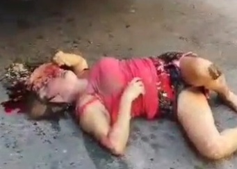 [CRACKED SKULL]WOMAN DIED HIT BY A BUS