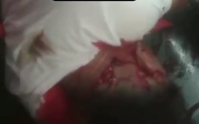 Young man executed in his car by sicario 