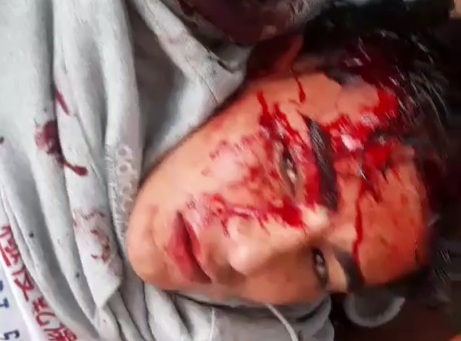 Thief punished hard for stealing from old lady 