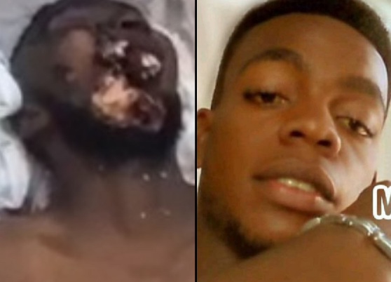 Young man killed by machete during clashes between gangs in Haiti 