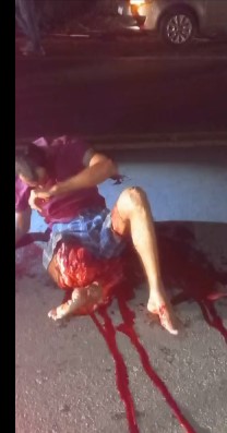 the man had one leg horribly destroyed and the other dies violently in