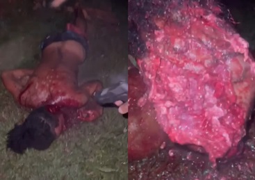 Rival Shot Dozens of Times in the Head is Unrecognizable