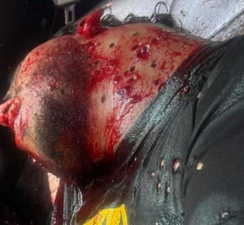 Couple executed in their car by sicario in Colombia 