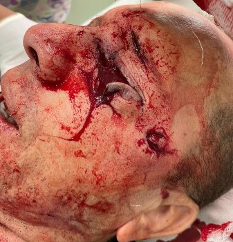 police officer is a rookie he was shot in the eye