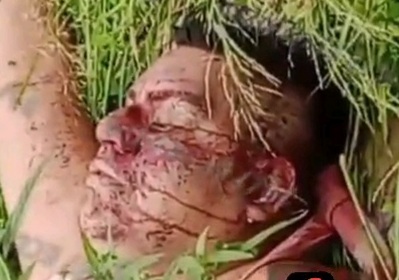 LIFELESS MALE BODY WAS FOUND IN FOREST 