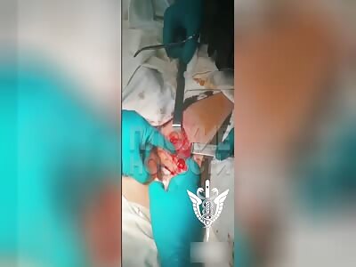 There's Huge Projectile In Thigh